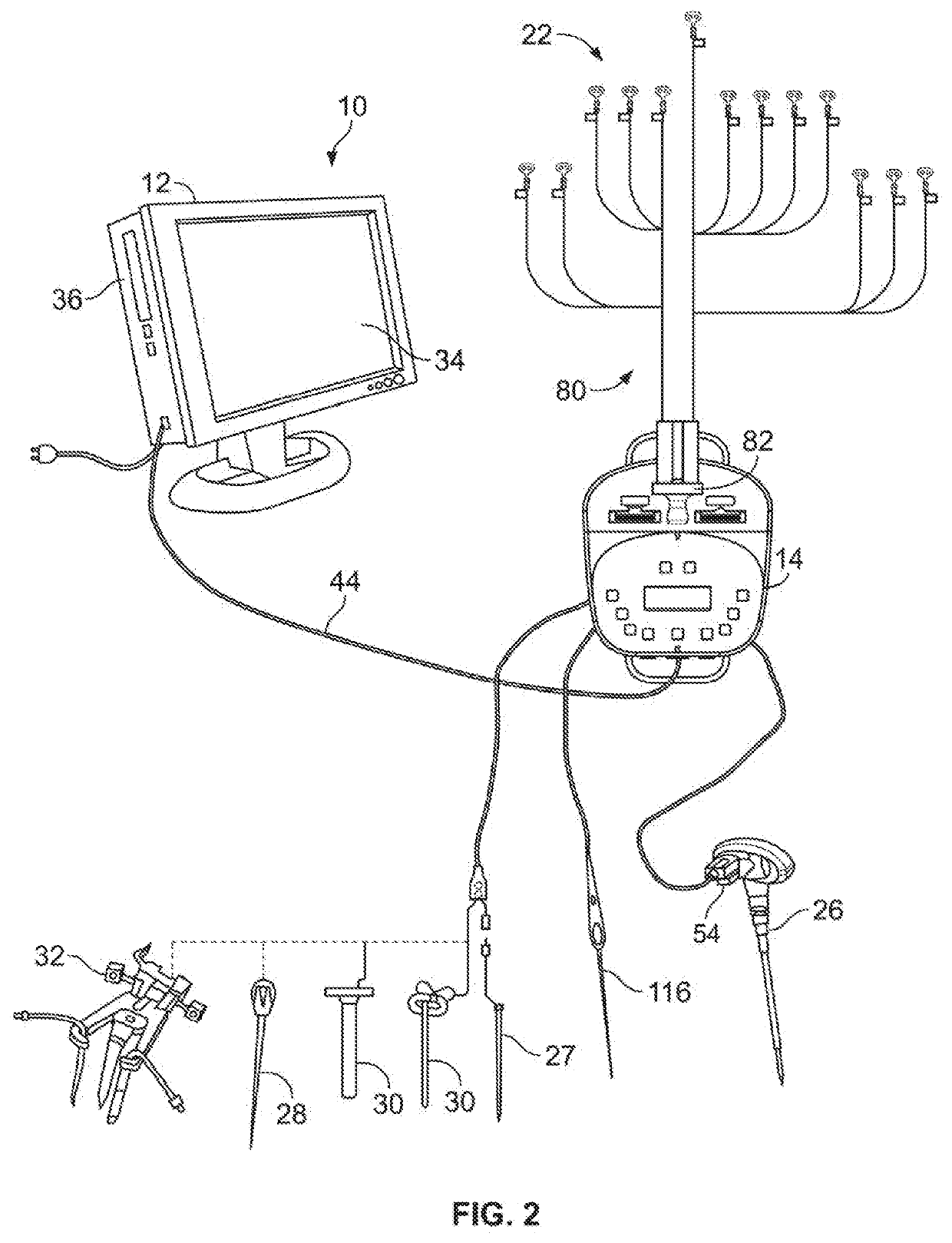 Systems and Methods for Performing Neurophysiologic Monitoring