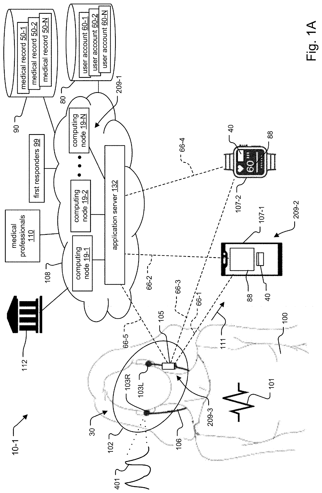 System and Method for Leak Correction and Normalization of In-Ear Pressure Measurement for Hemodynamic Monitoring