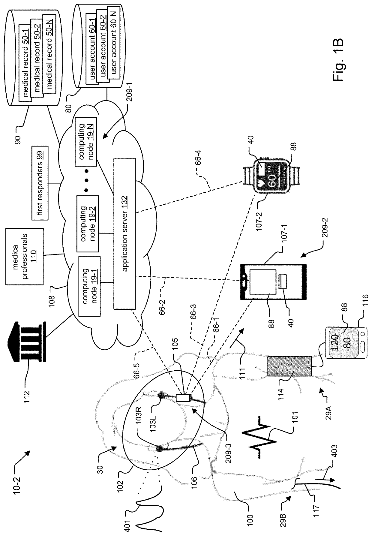 System and Method for Leak Correction and Normalization of In-Ear Pressure Measurement for Hemodynamic Monitoring