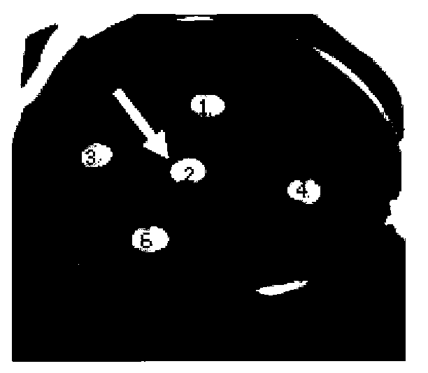 Mycelium extract for helicobacter pylori-resistant biological medicine and preparation technology thereof