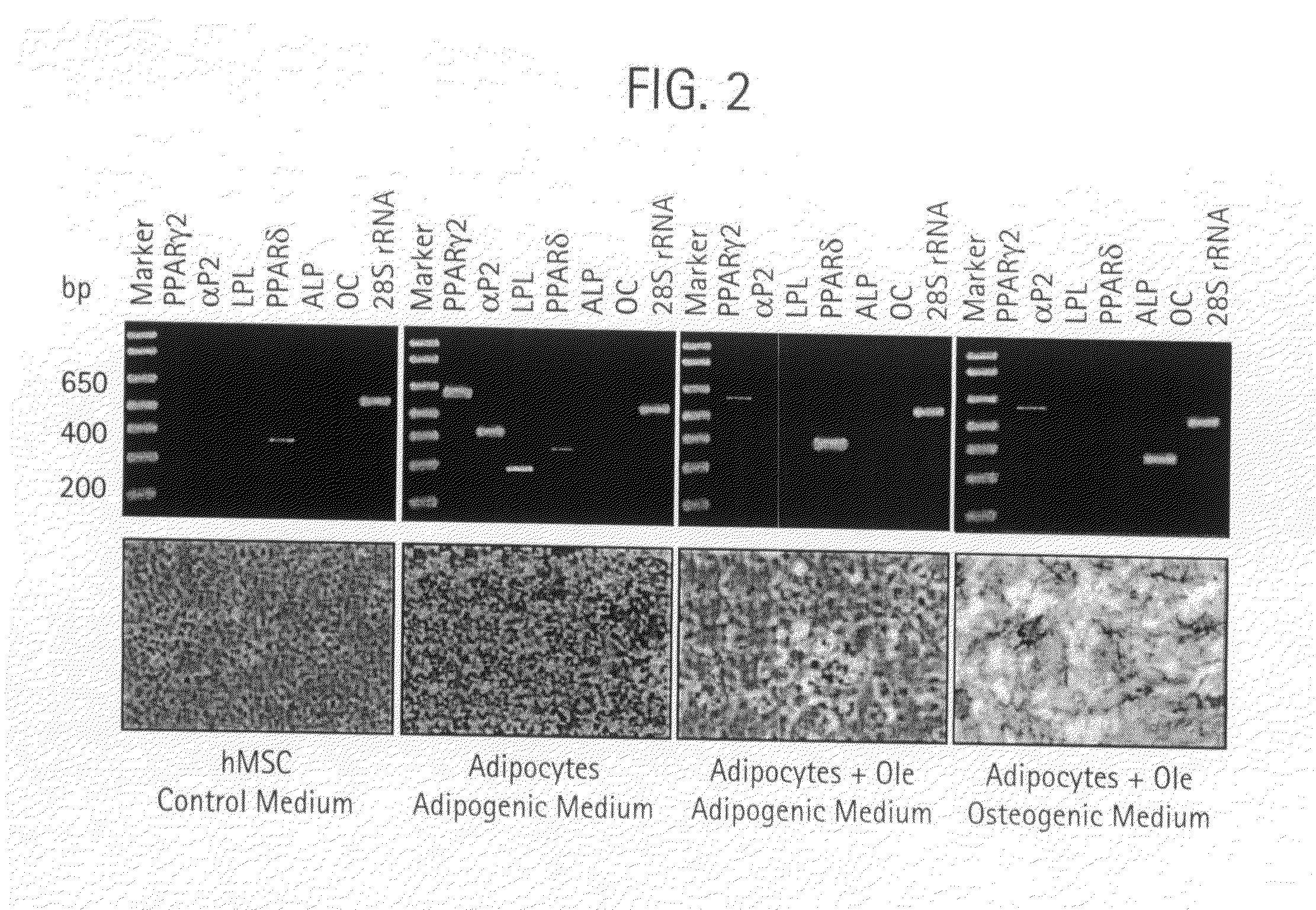 Compositions and methods for treating obesity, obesity related disorders and for inhibiting the infectivity of human immunodeficiency virus