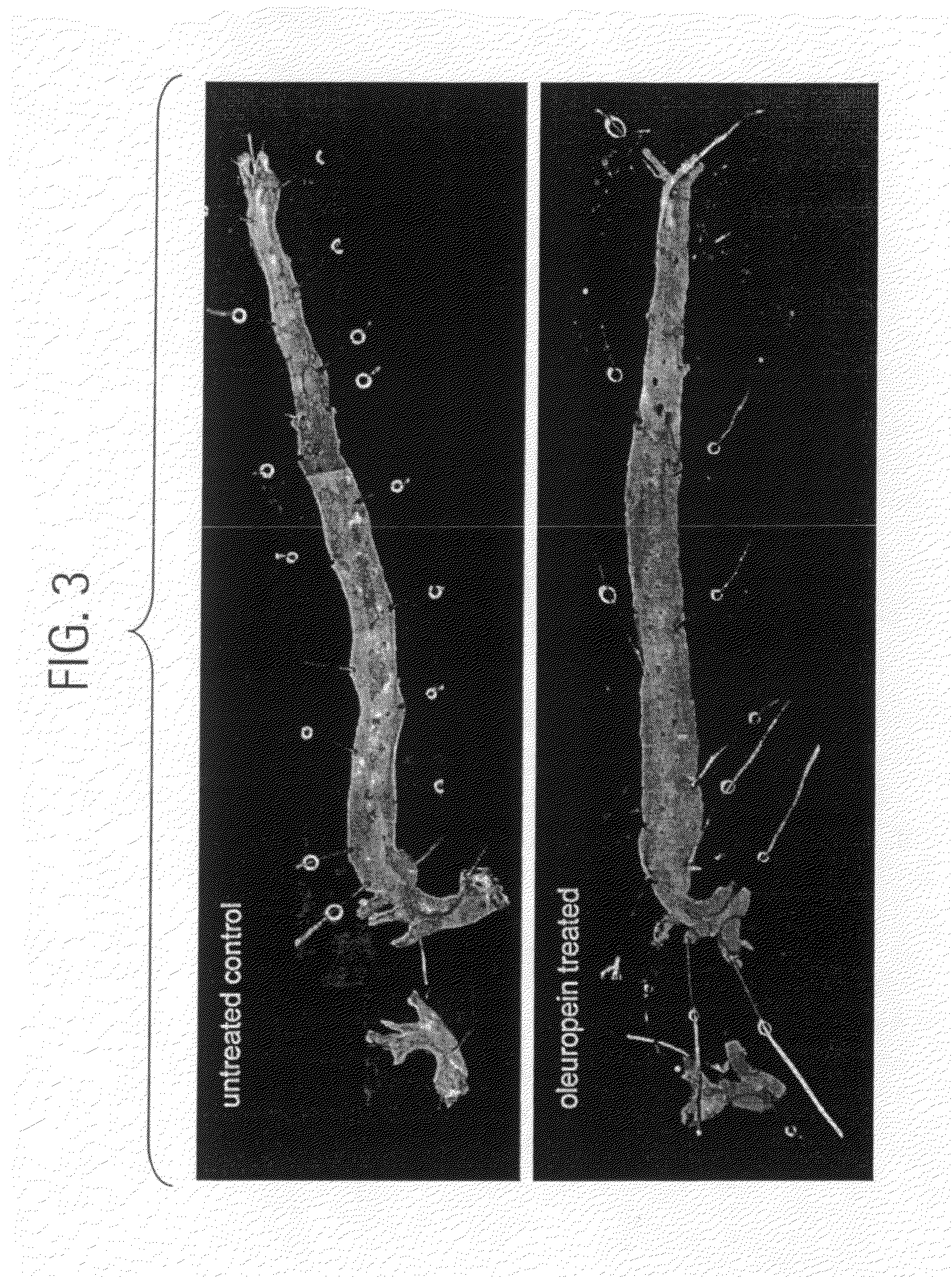 Compositions and methods for treating obesity, obesity related disorders and for inhibiting the infectivity of human immunodeficiency virus