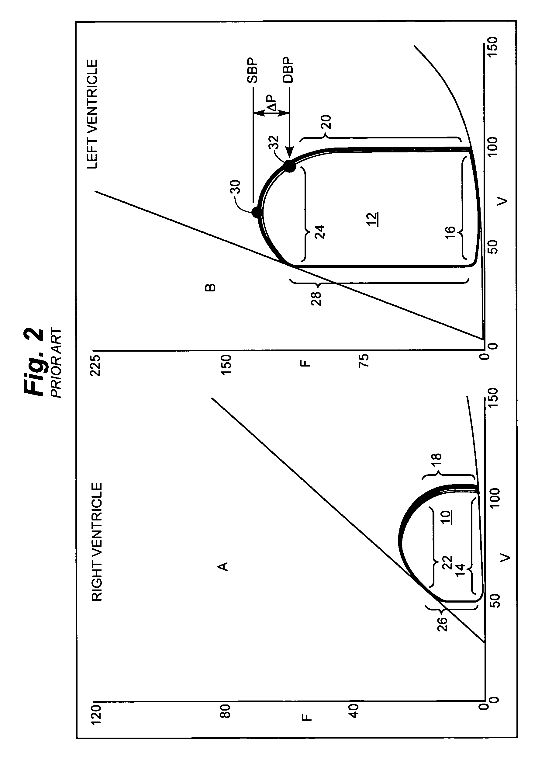 Cardiac stimulation apparatus and method for the control of hypertension