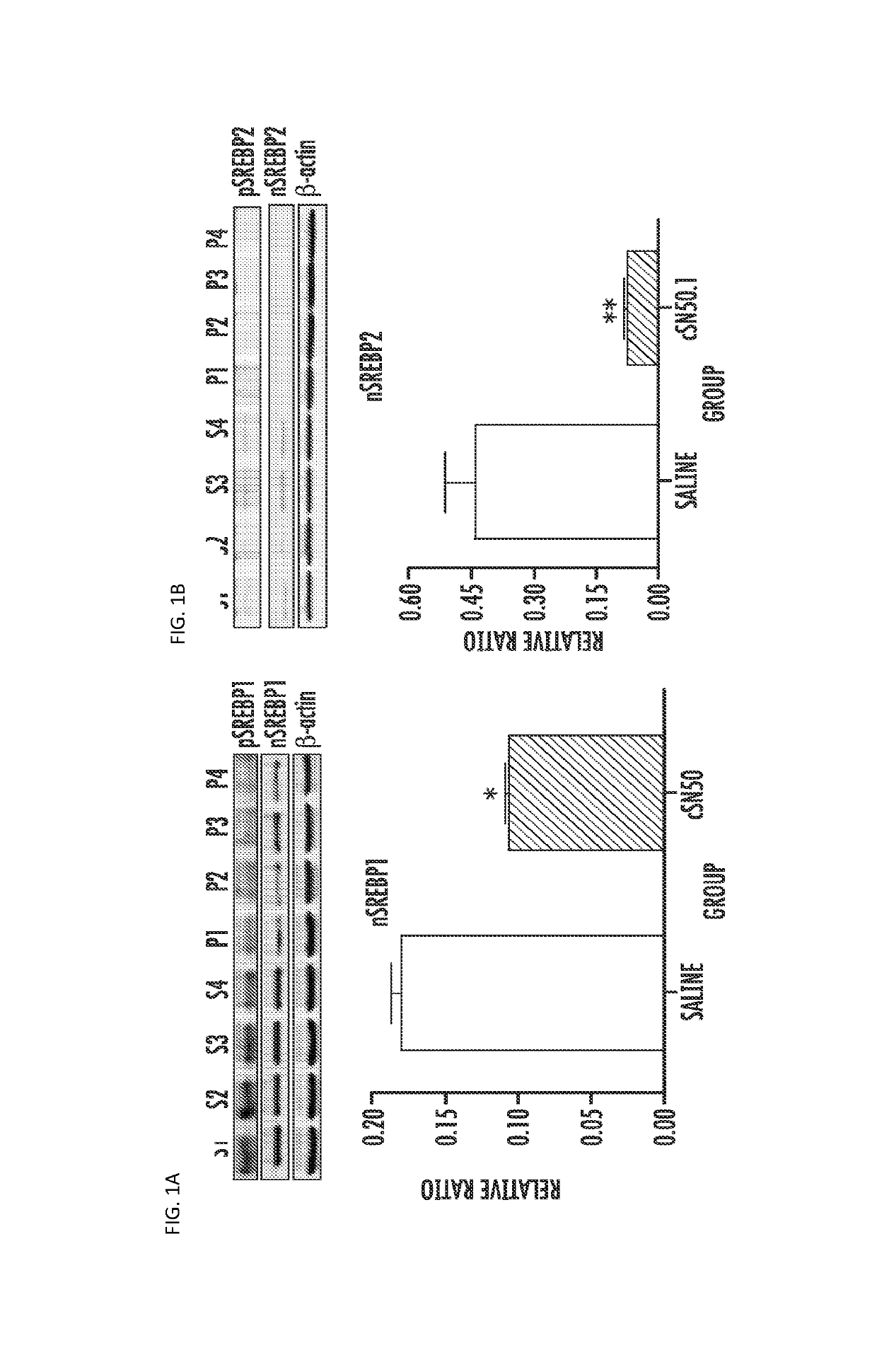 Compositions and methods for treating and preventing hyperlipidemia, fatty liver, atherosclerosis and other disorders associated with metabolic syndrome