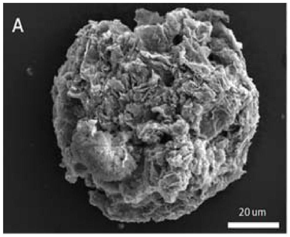 A kind of ultrahigh molecular weight polyethylene catalyst and preparation method thereof