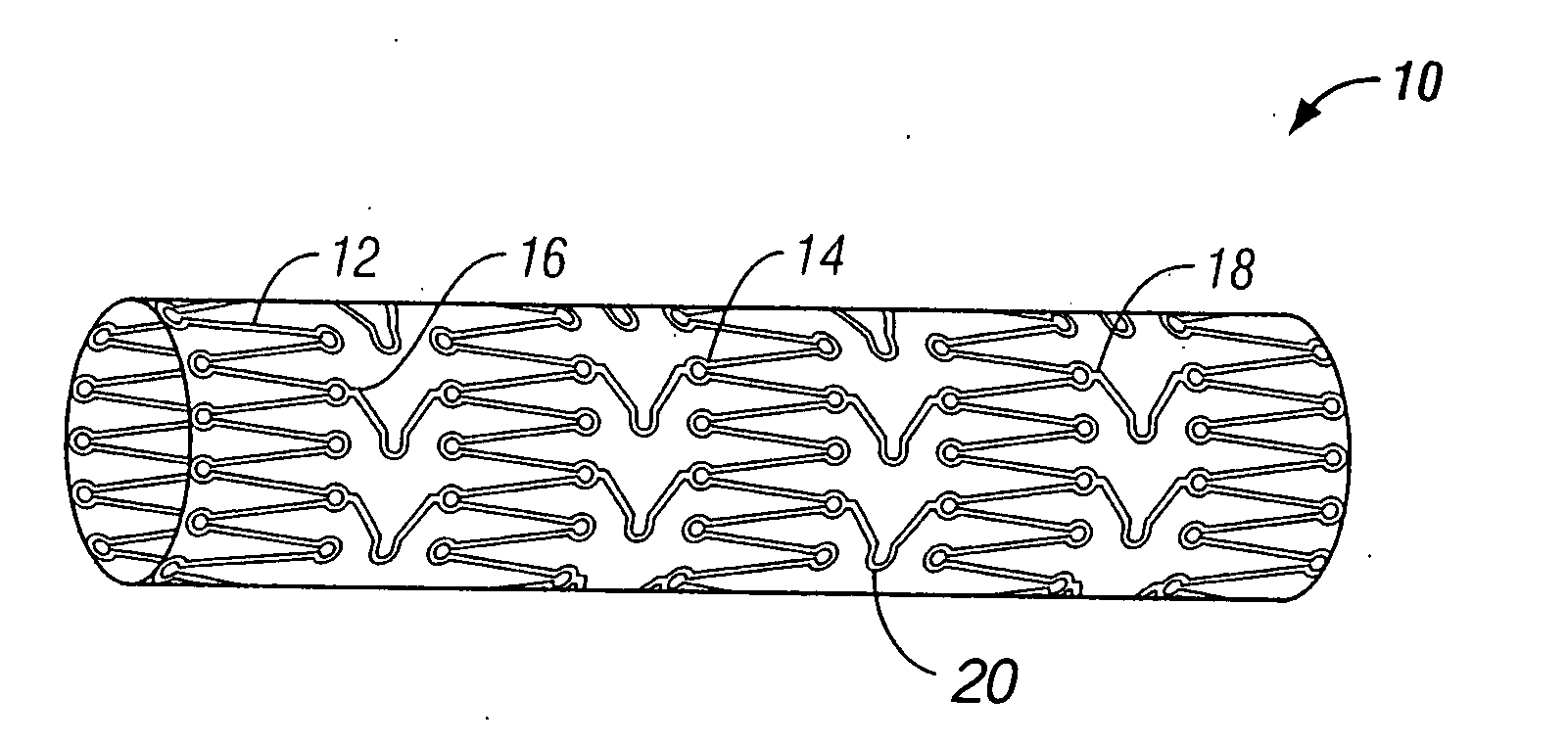 Implantable expandable medical devices having regions of differential mechanical properties and methods of making same