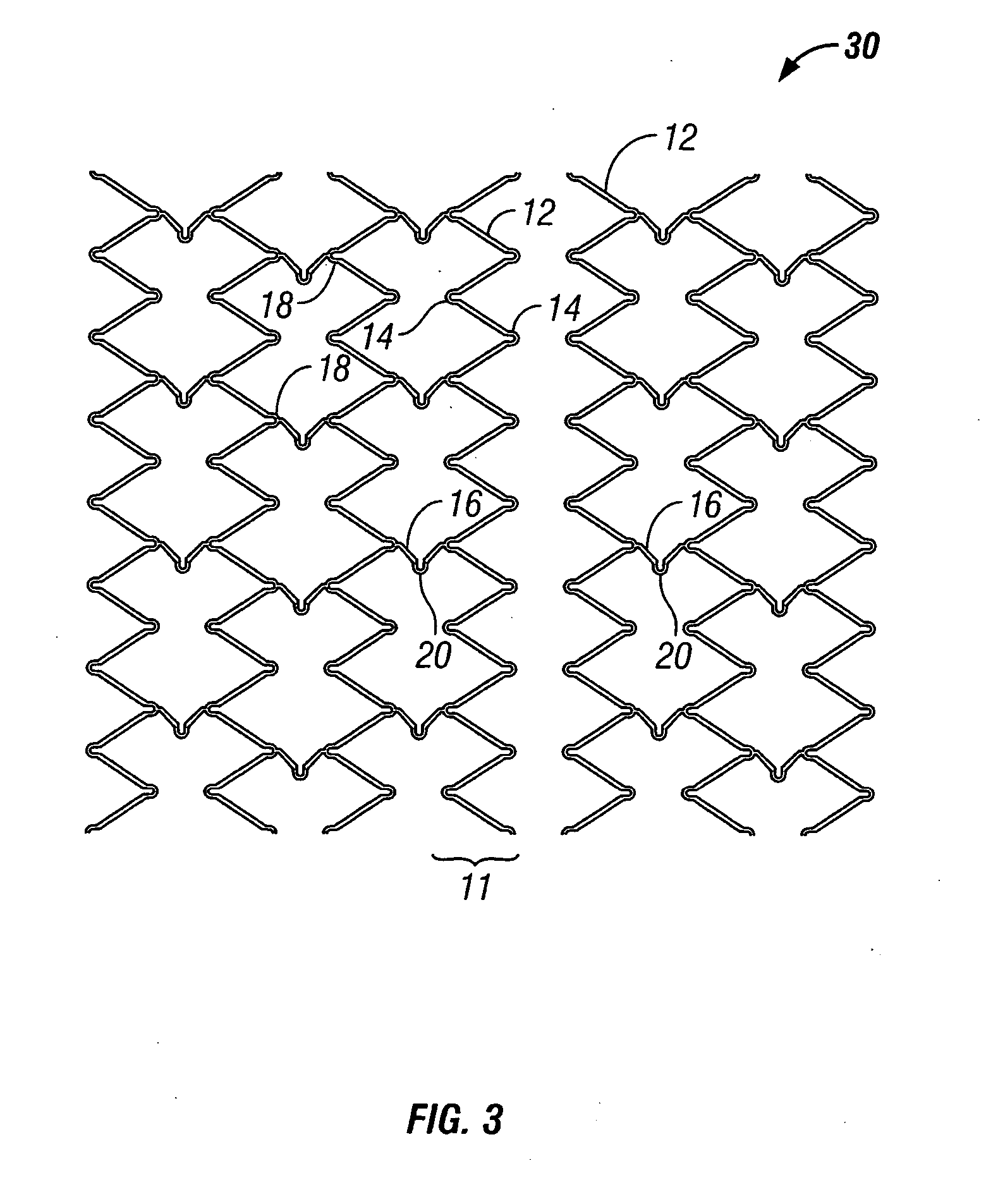 Implantable expandable medical devices having regions of differential mechanical properties and methods of making same