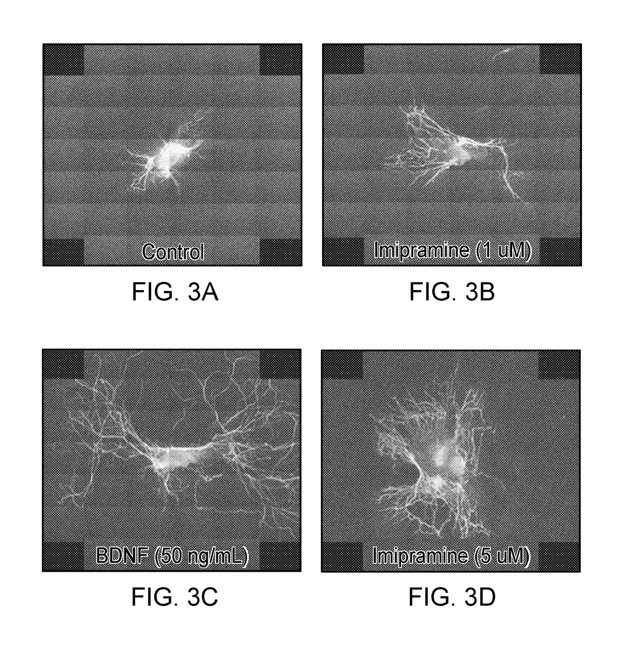 Treating Cochlear Synaptopathy