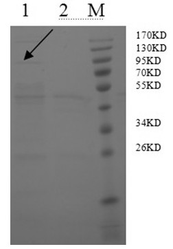 Preparation method of porcine epidemic diarrhea recombinant adenovirus vaccine