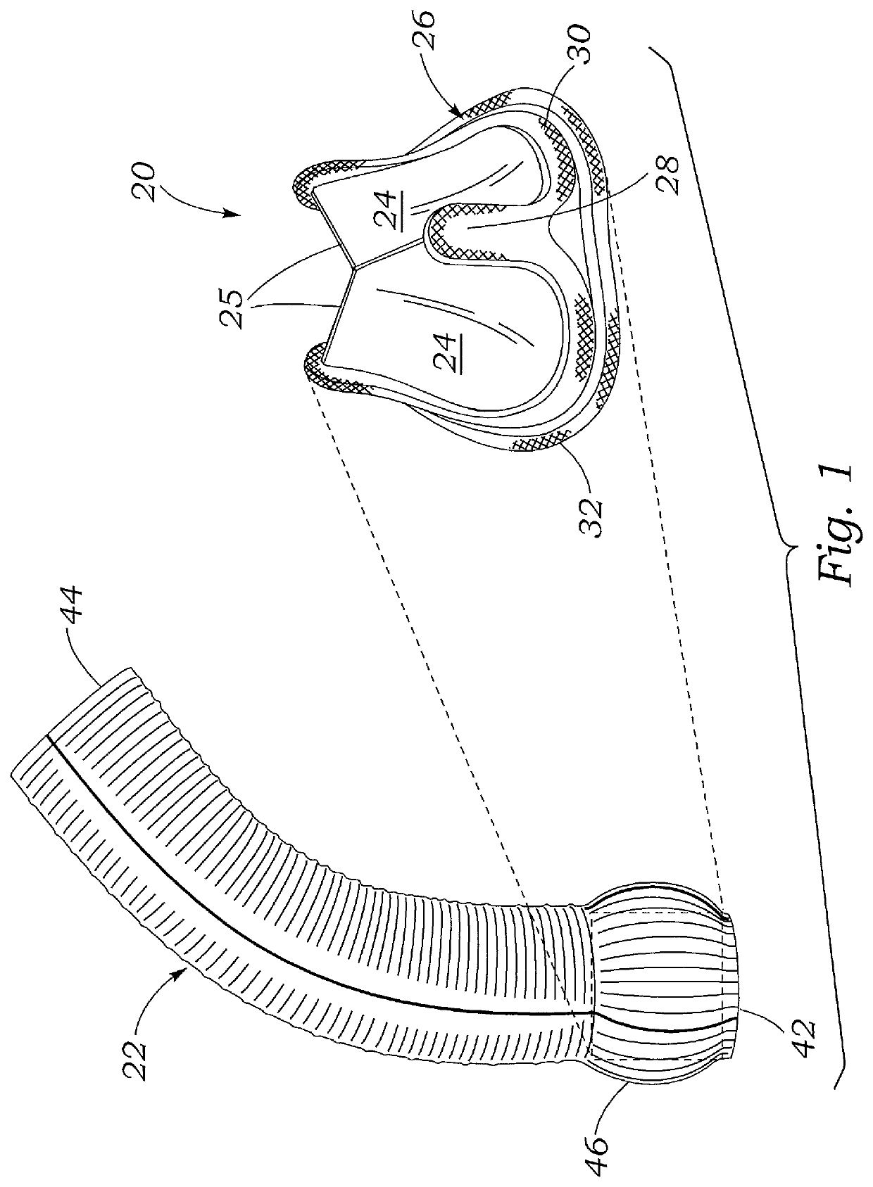 Valved aortic conduits