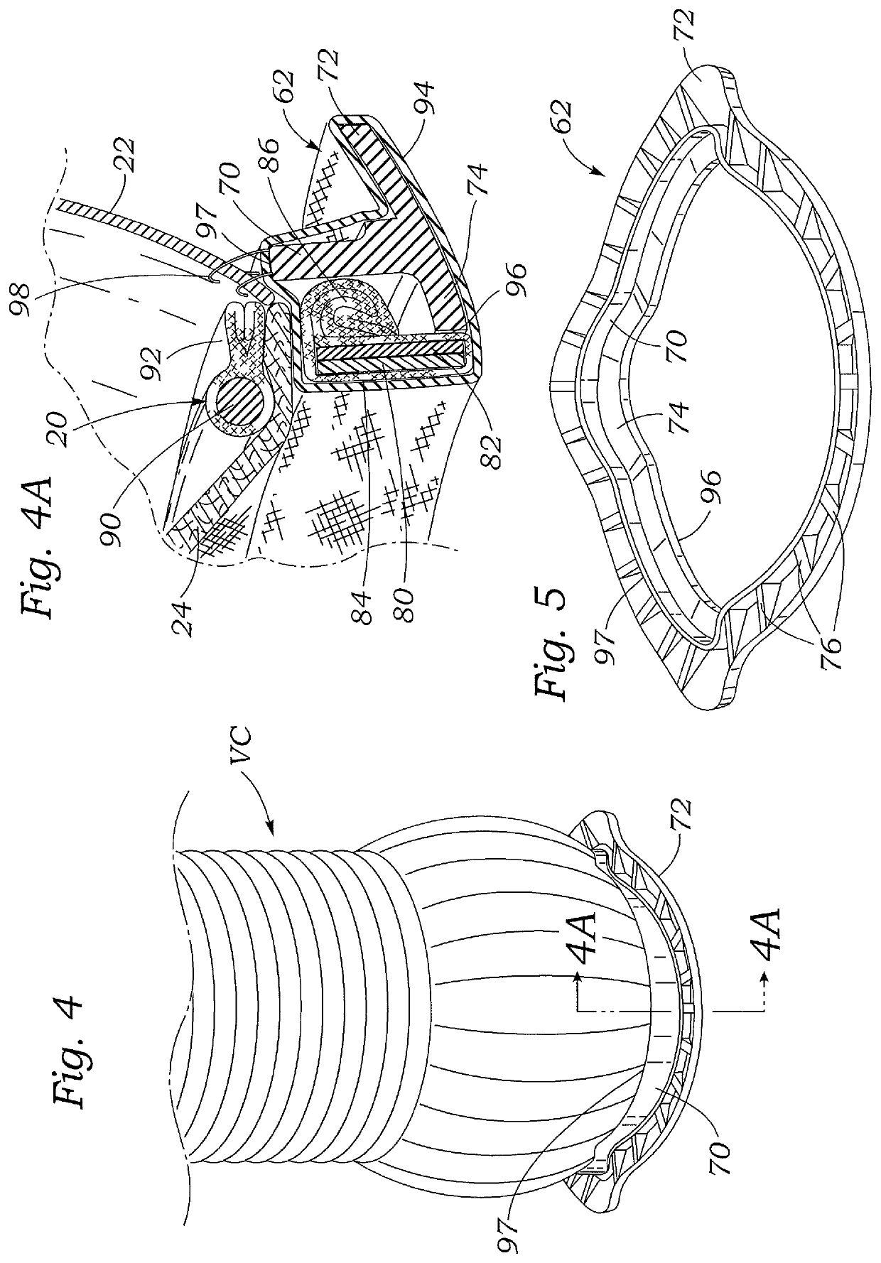 Valved aortic conduits