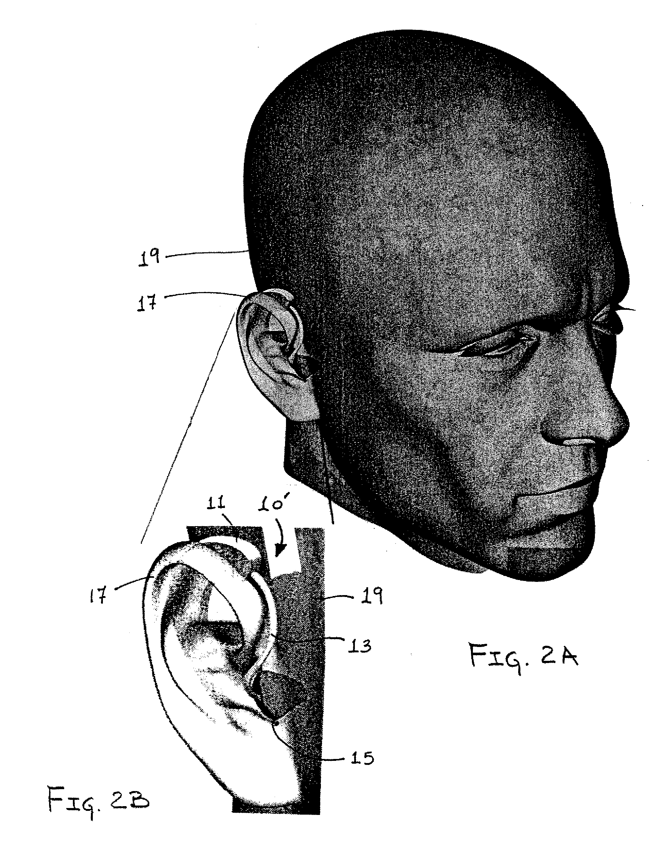 System and method for detecting deviations in nominal gait patterns