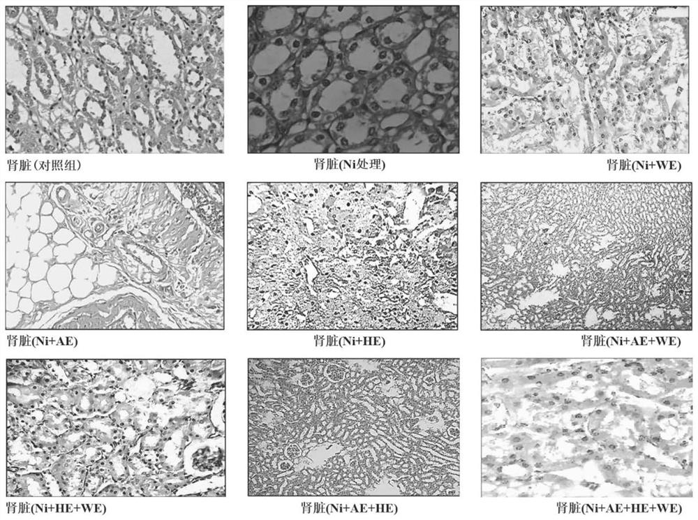 Application of cannabis sativa extract and medicine containing cannabis sativa extract