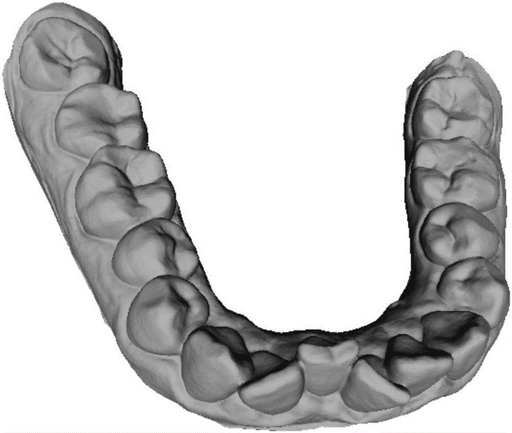 Method for automatically segmenting whole dental triangular mesh model