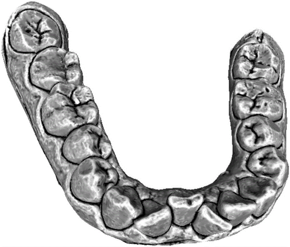 Method for automatically segmenting whole dental triangular mesh model