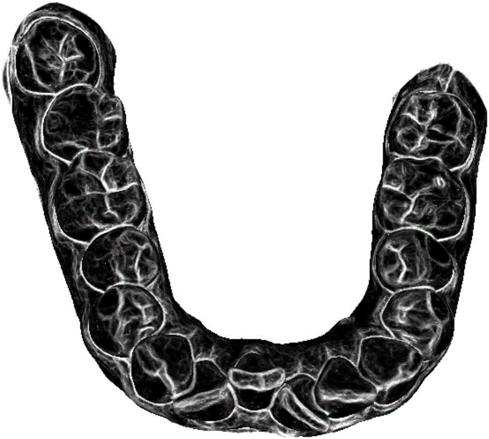 Method for automatically segmenting whole dental triangular mesh model