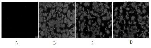 A kind of method utilizing serum-free culture medium to produce pedv attenuated vaccine