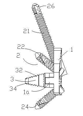 Cervical vertebra fixing plate with odontoid process fusing device