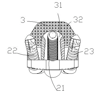 Cervical vertebra fixing plate with odontoid process fusing device