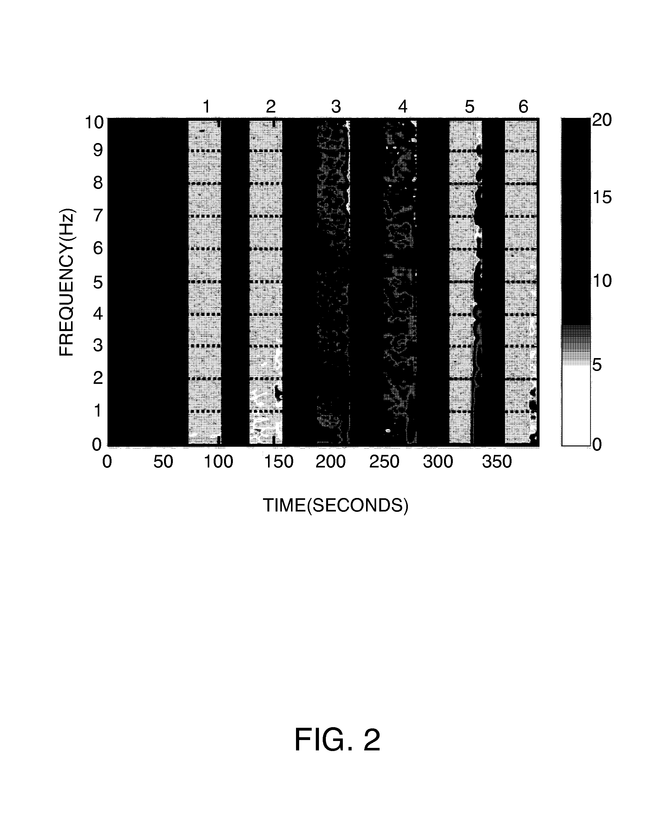 Method and apparatus for continuous measurement of motor symptoms in parkinson's disease and essential tremor with wearable sensors