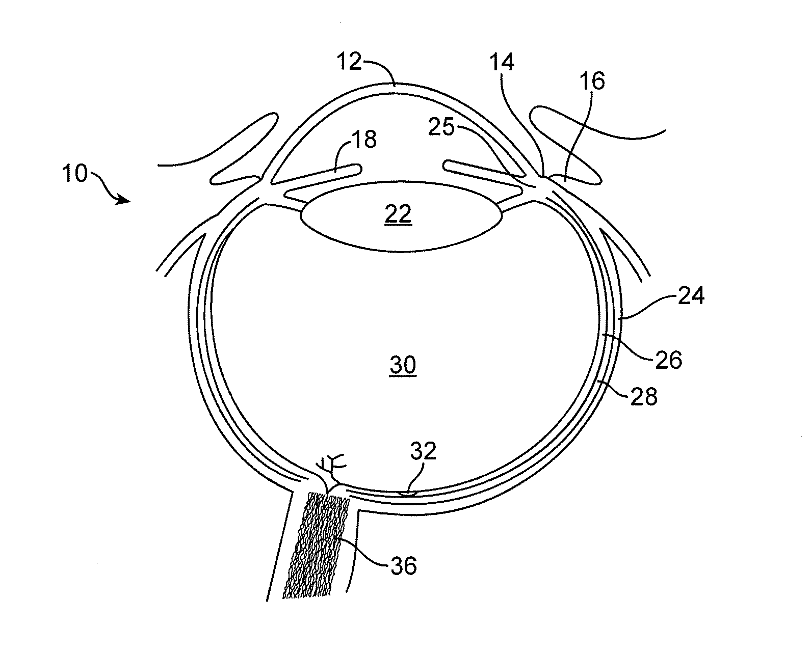 Implantable therapeutic device