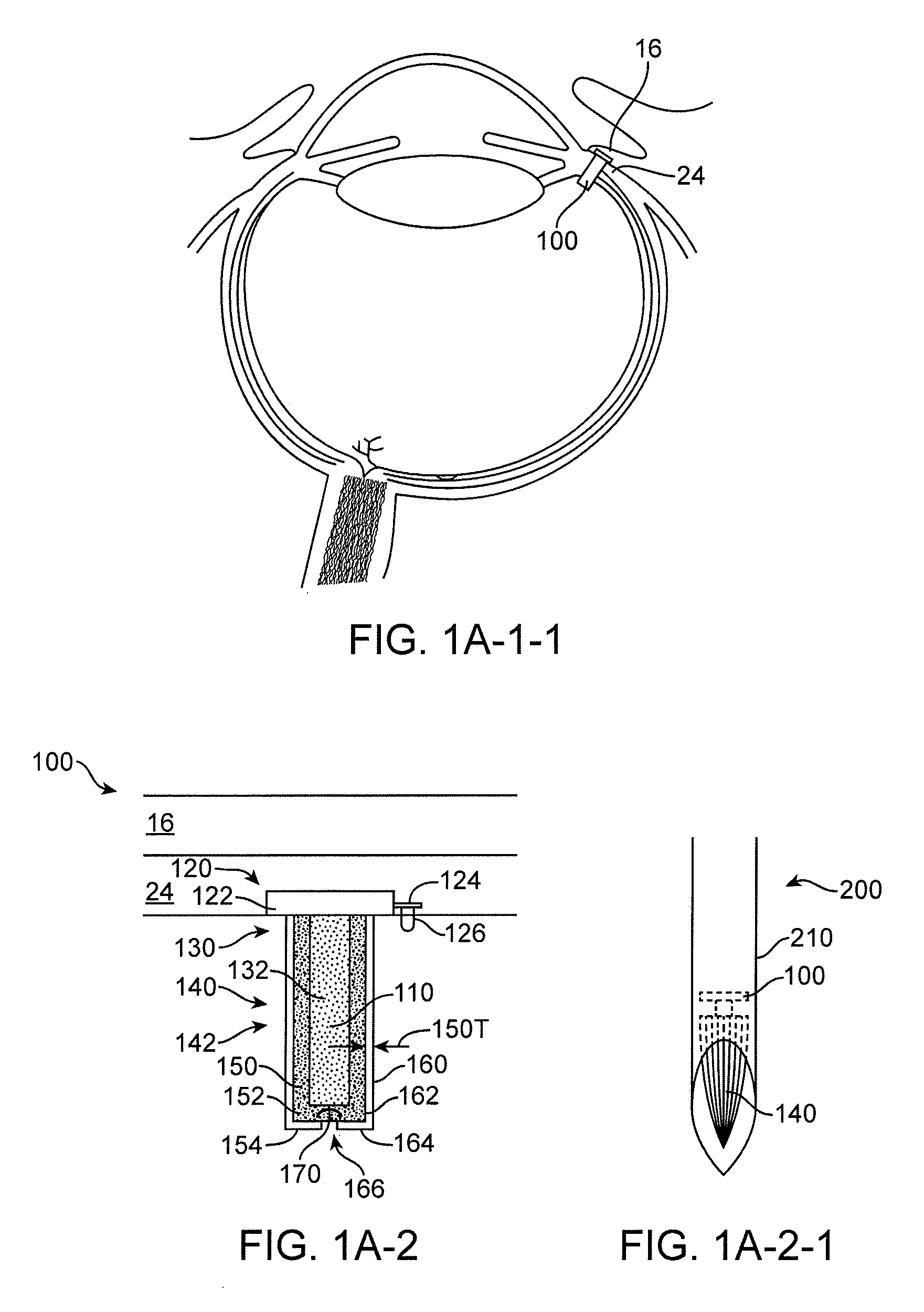 Implantable therapeutic device