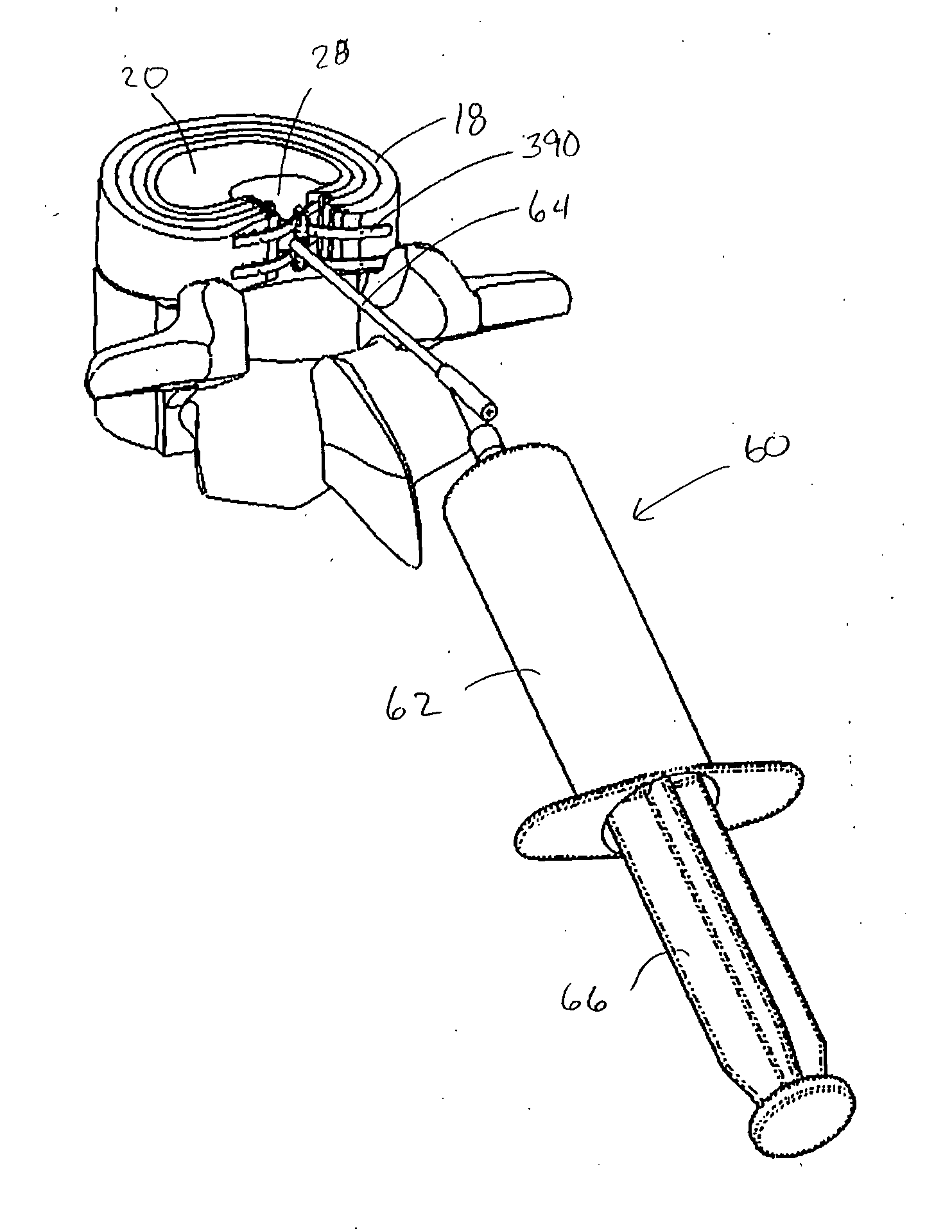 Systems and methods for augmenting intervertebral discs