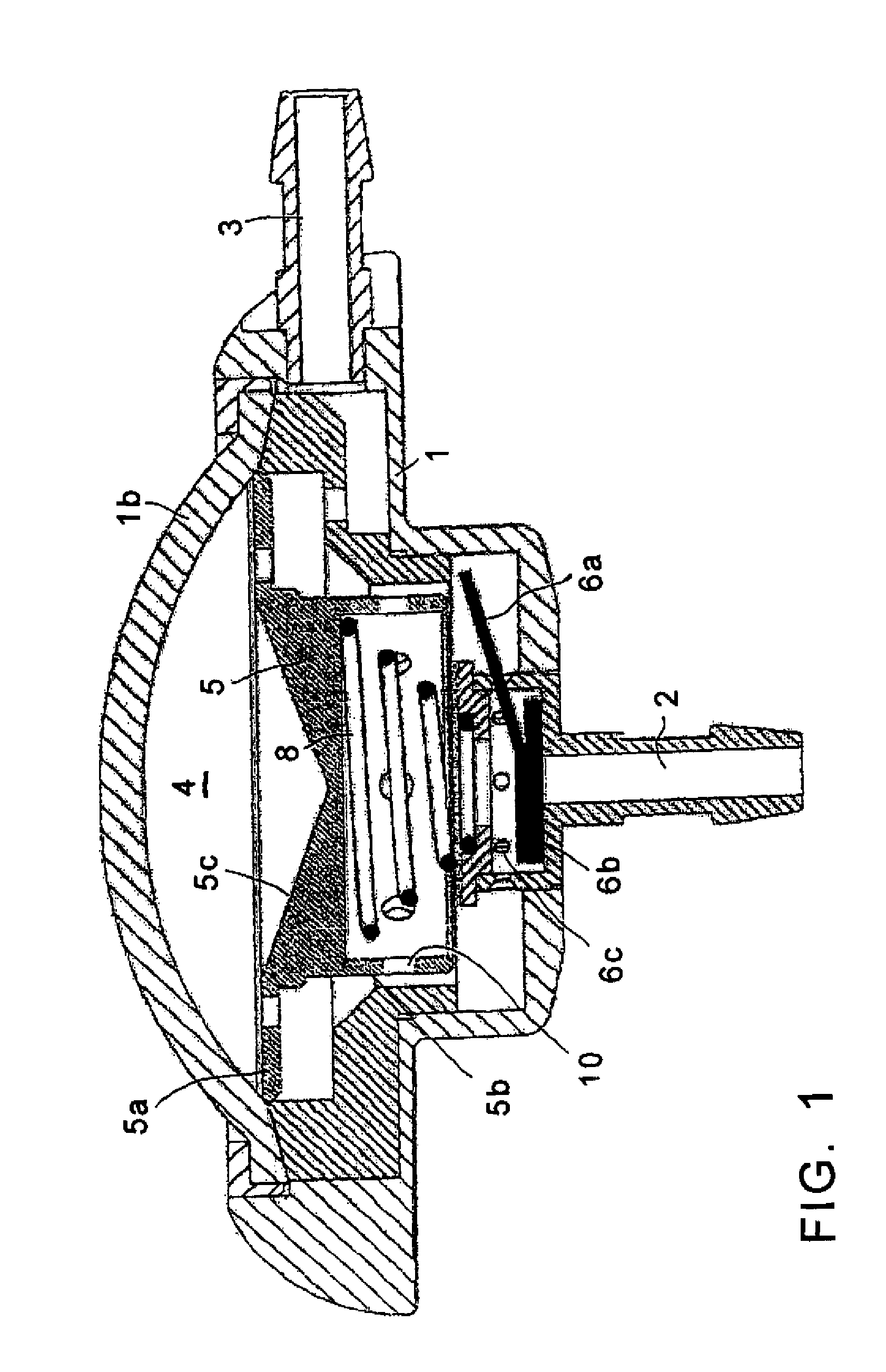 Implantable hydrocephalus shunt system