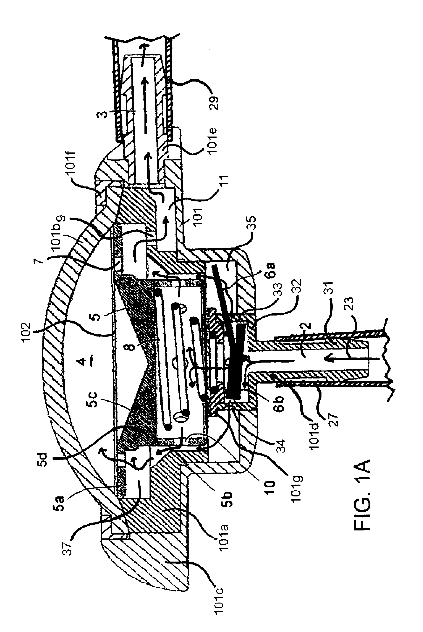 Implantable hydrocephalus shunt system