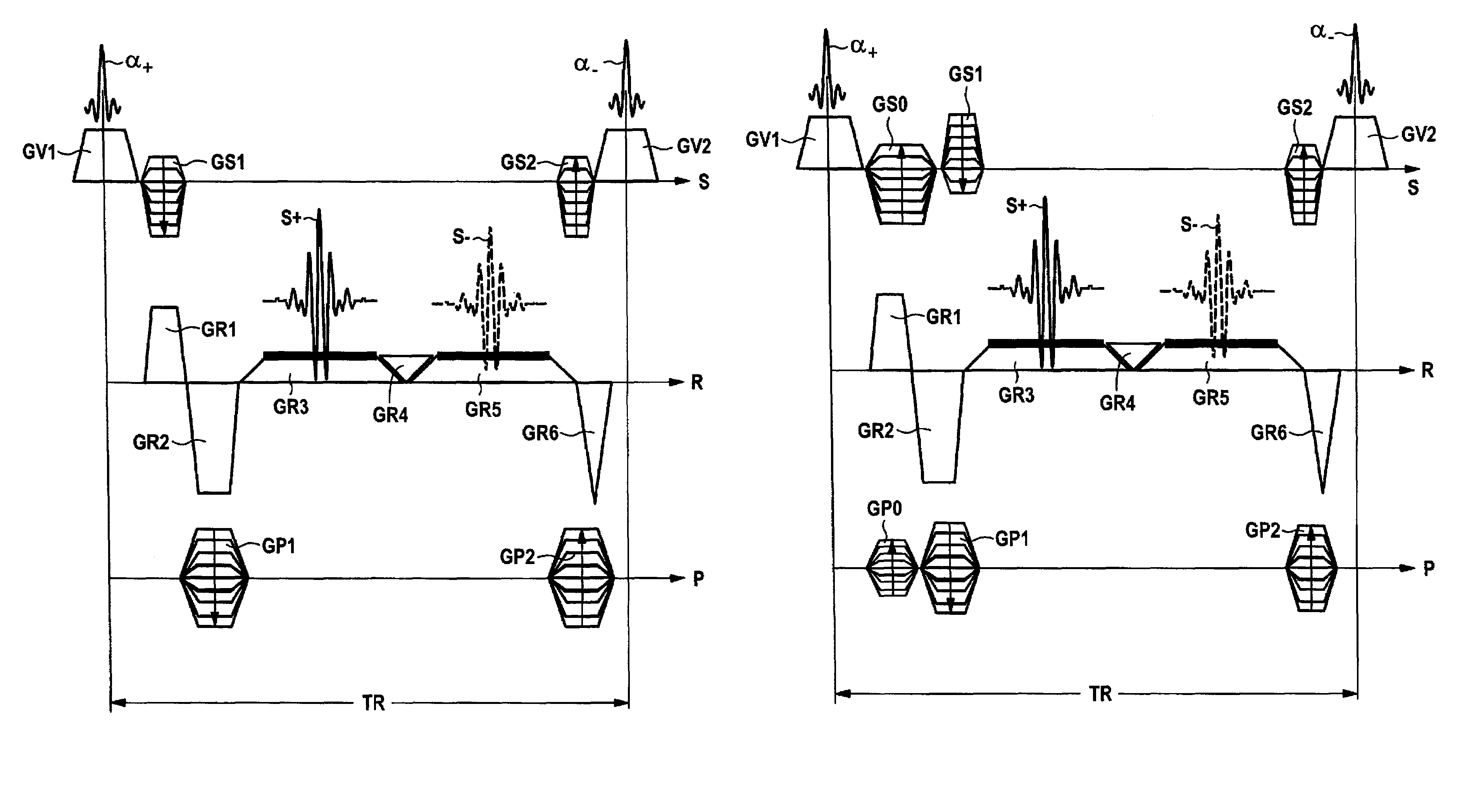 Double echo magnetic resonance imaging sequence and apparatus for the implementation thereof