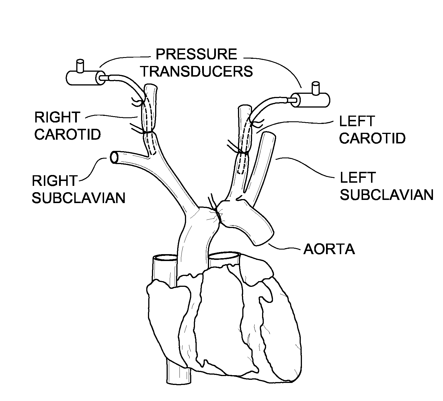 Methods, compositions and transgenic models related to the interaction of t-cadherin and adiponectin