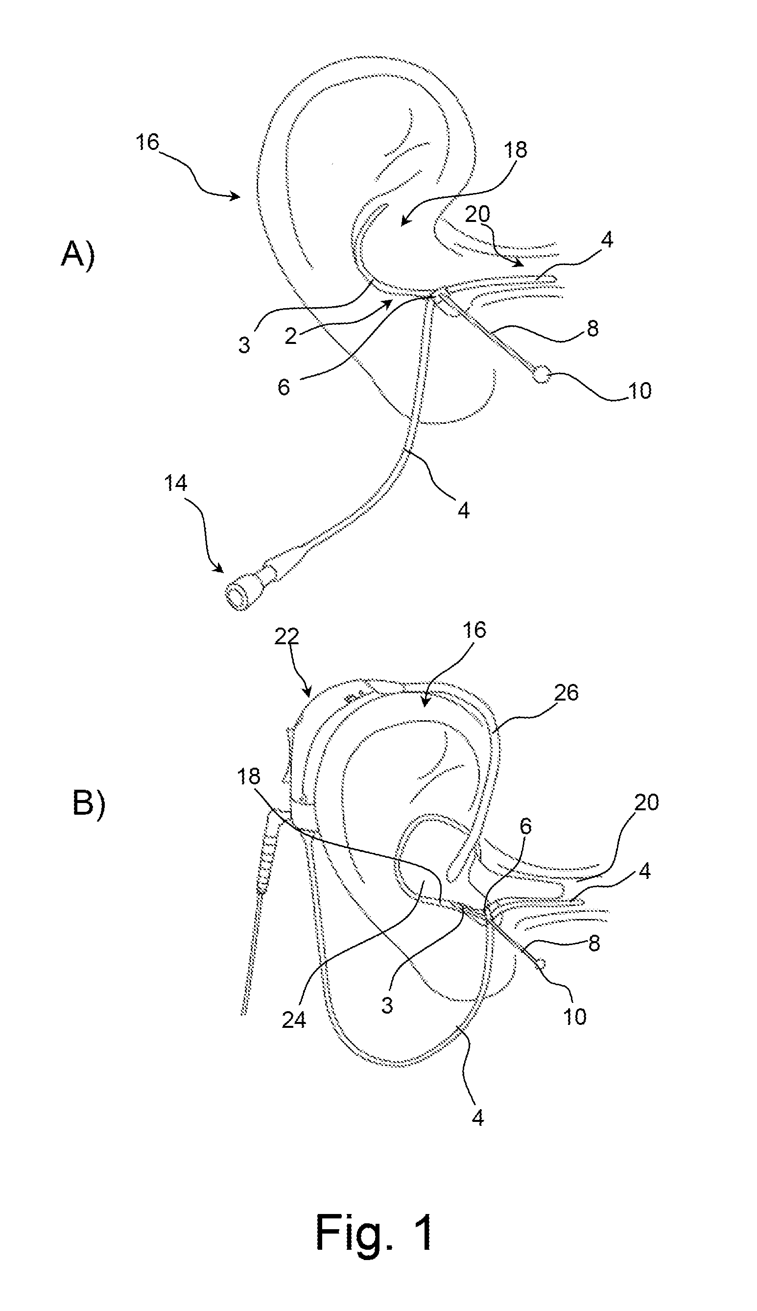 Ear strap for a probe tube