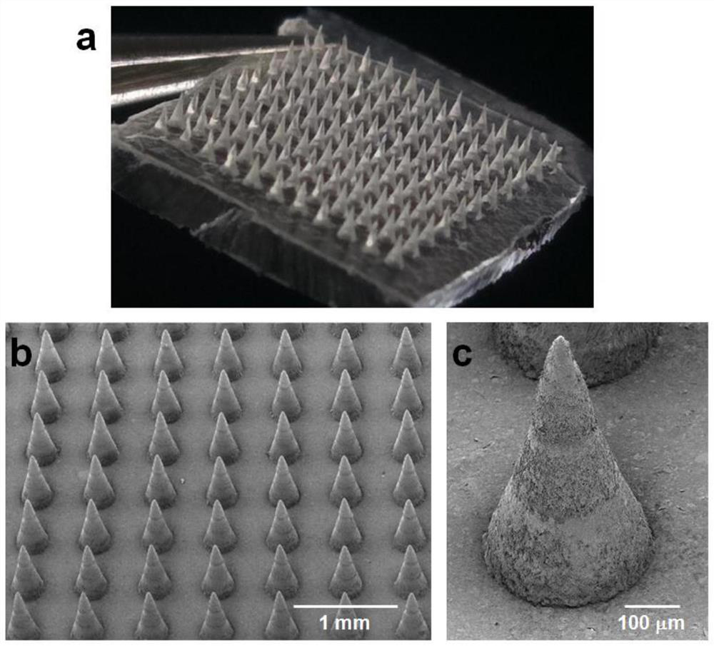 A 3D printed microneedle patch for intelligent blood sugar regulation and its preparation method