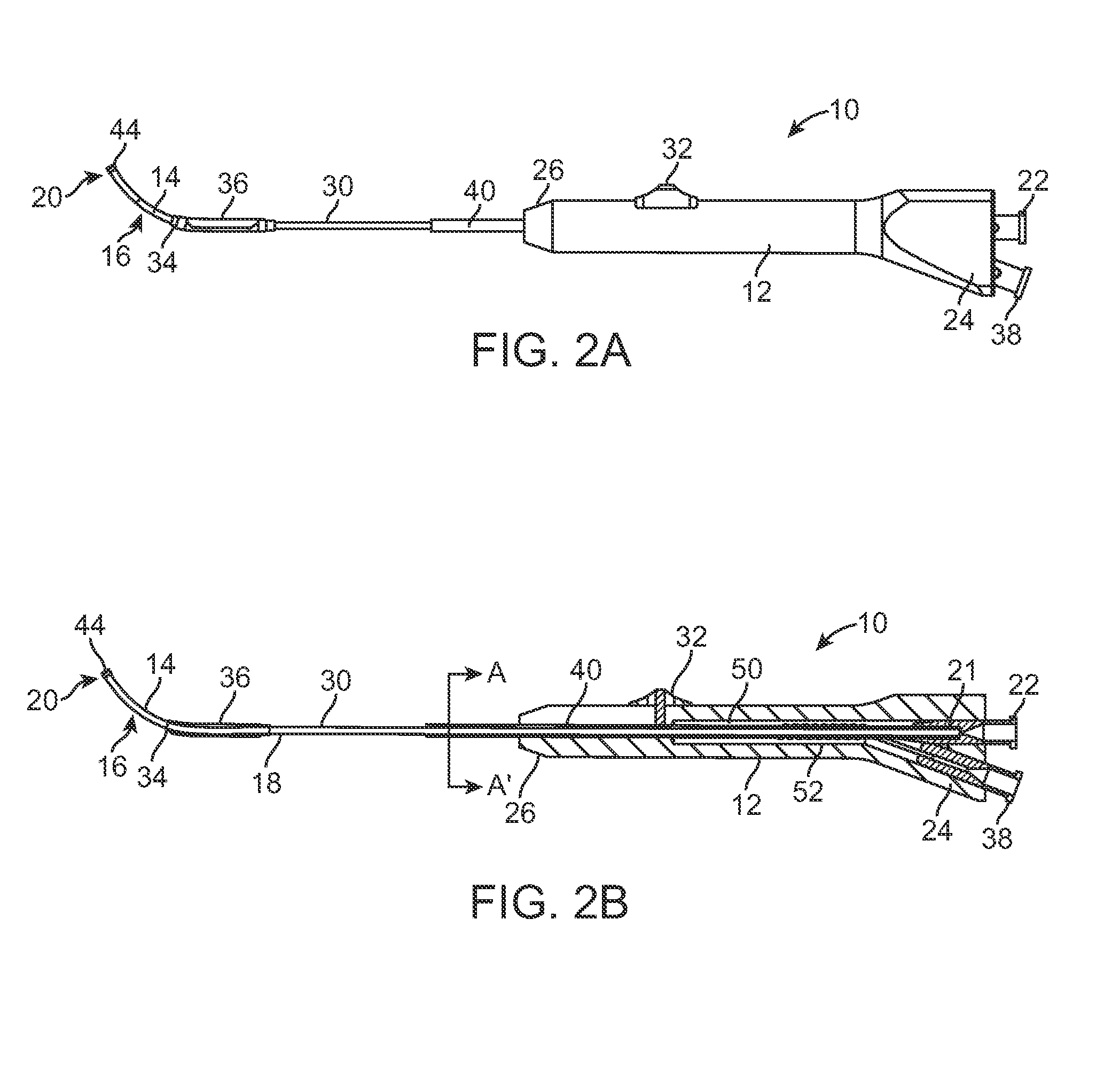 Frontal sinus dilation catheter