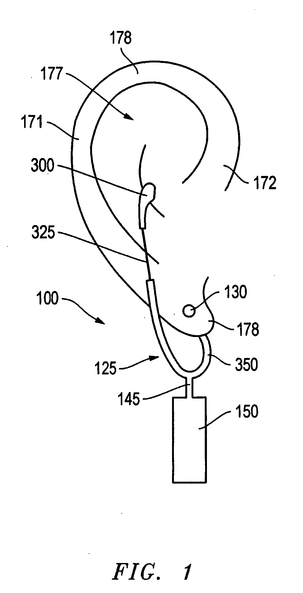 Wireless earring assembly