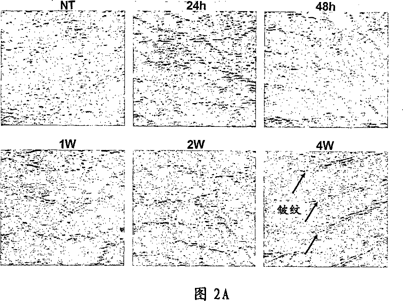 Prevention or improvement of wrinkles by using ADAM activation inhibitor