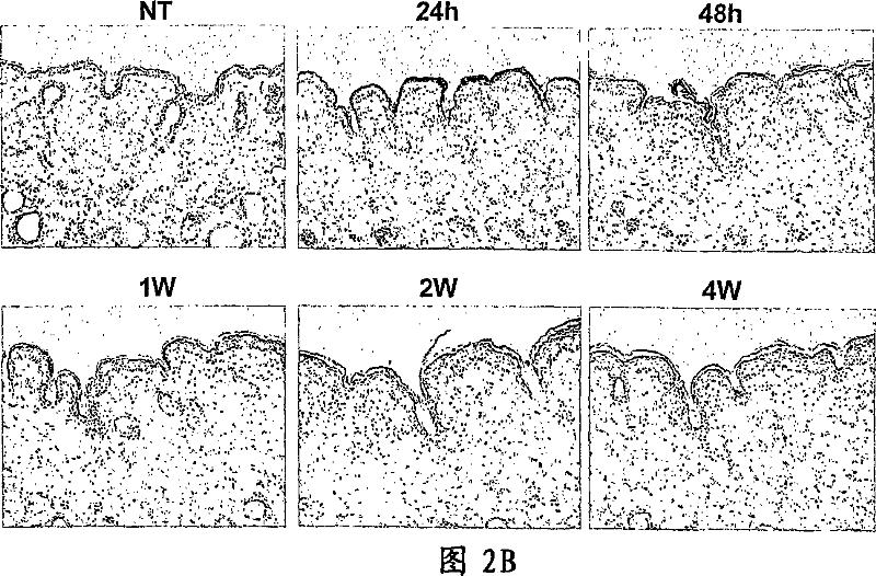 Prevention or improvement of wrinkles by using ADAM activation inhibitor