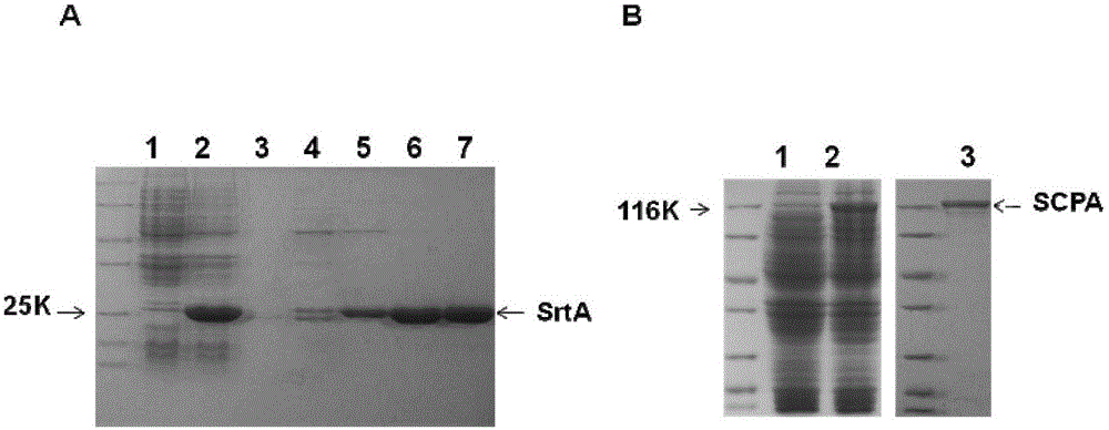 Combined vaccine for inhibiting and / or preventing type A streptococcal infection