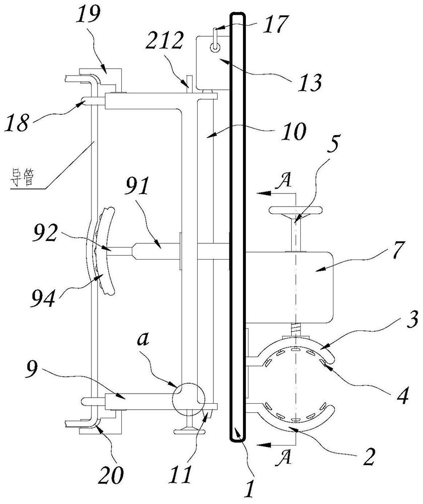 Colorectum fixing and pulling-out auxiliary device for gastrointestinal surgery