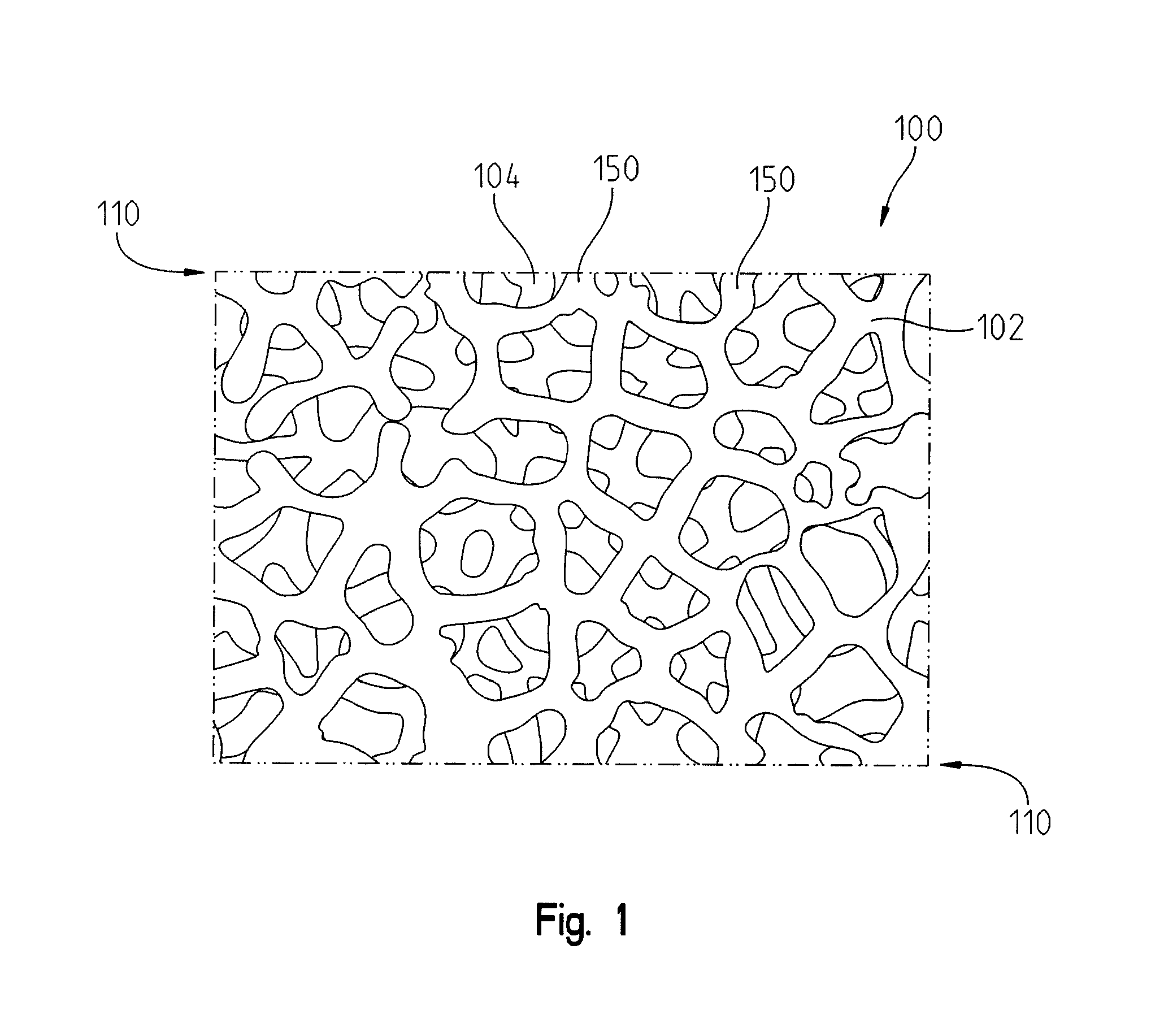 Composite device that combines porous metal and bone stimuli