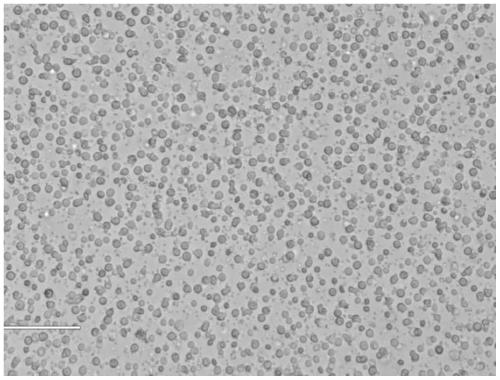 Separation method for separating peripheral blood mononuclear cells