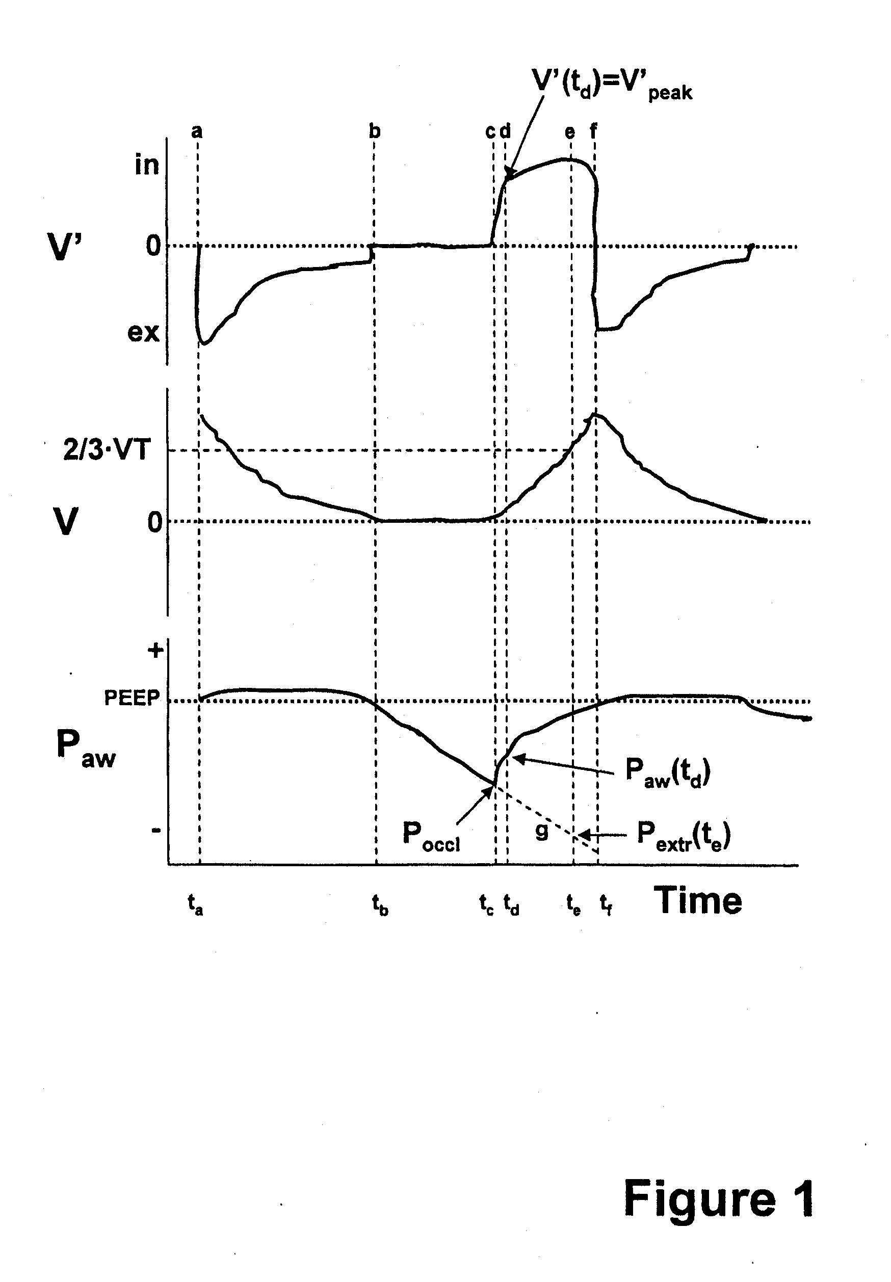 Method for determining the resistance of the respiratory system of a patient