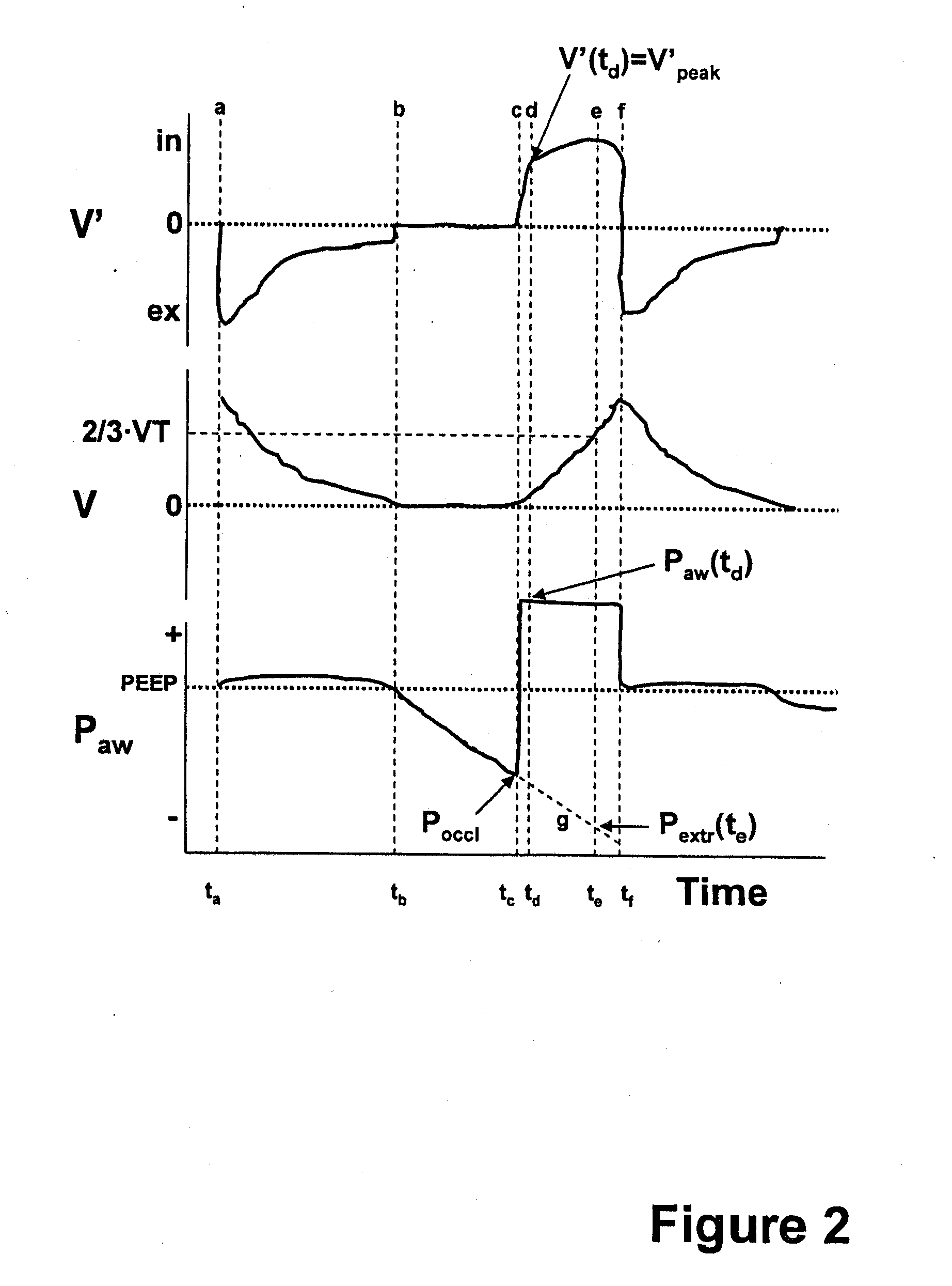 Method for determining the resistance of the respiratory system of a patient