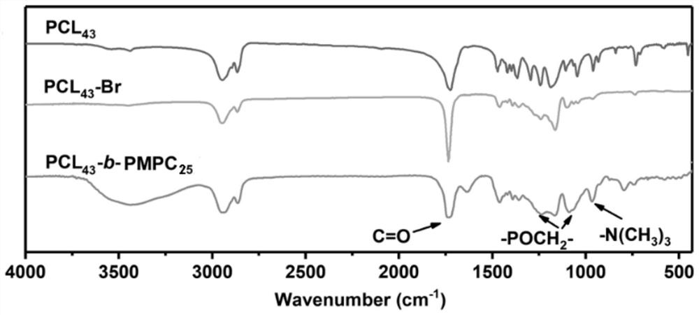 Phospholipid-like amphiphilic block copolymer-based ultrasonic contrast agent and preparation method thereof