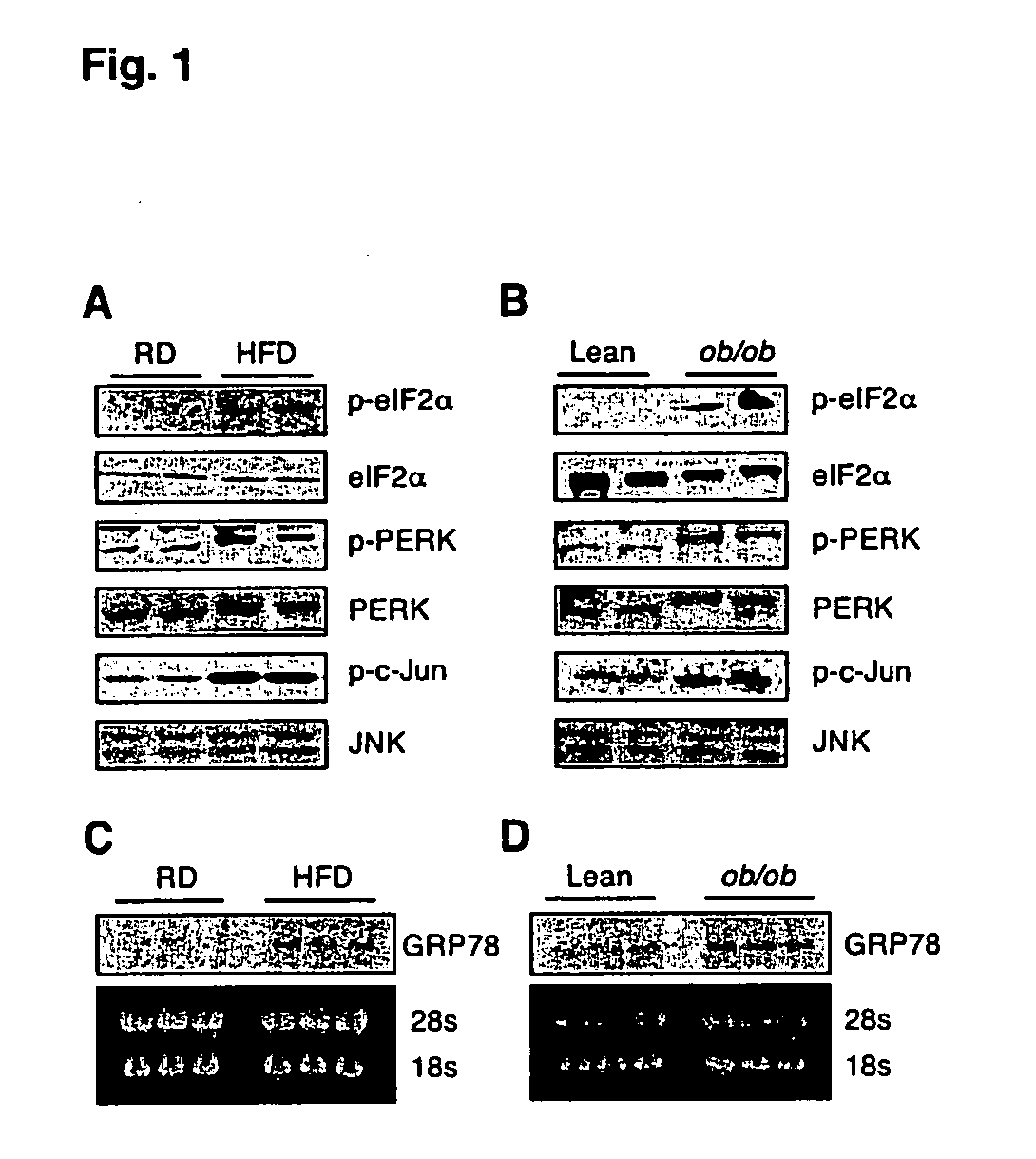 Modulation of XBP-1 activity for treatment of metabolic disorders