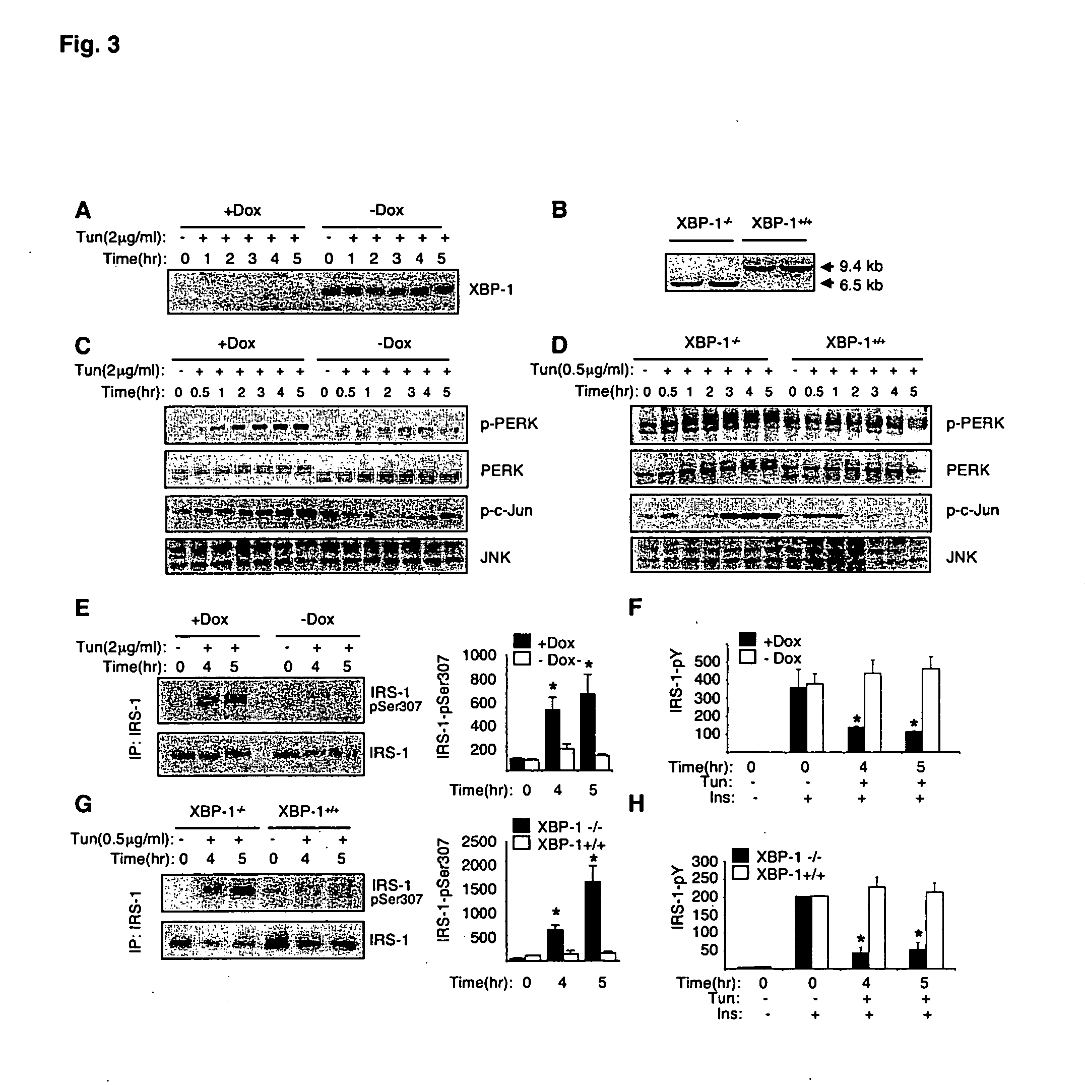 Modulation of XBP-1 activity for treatment of metabolic disorders