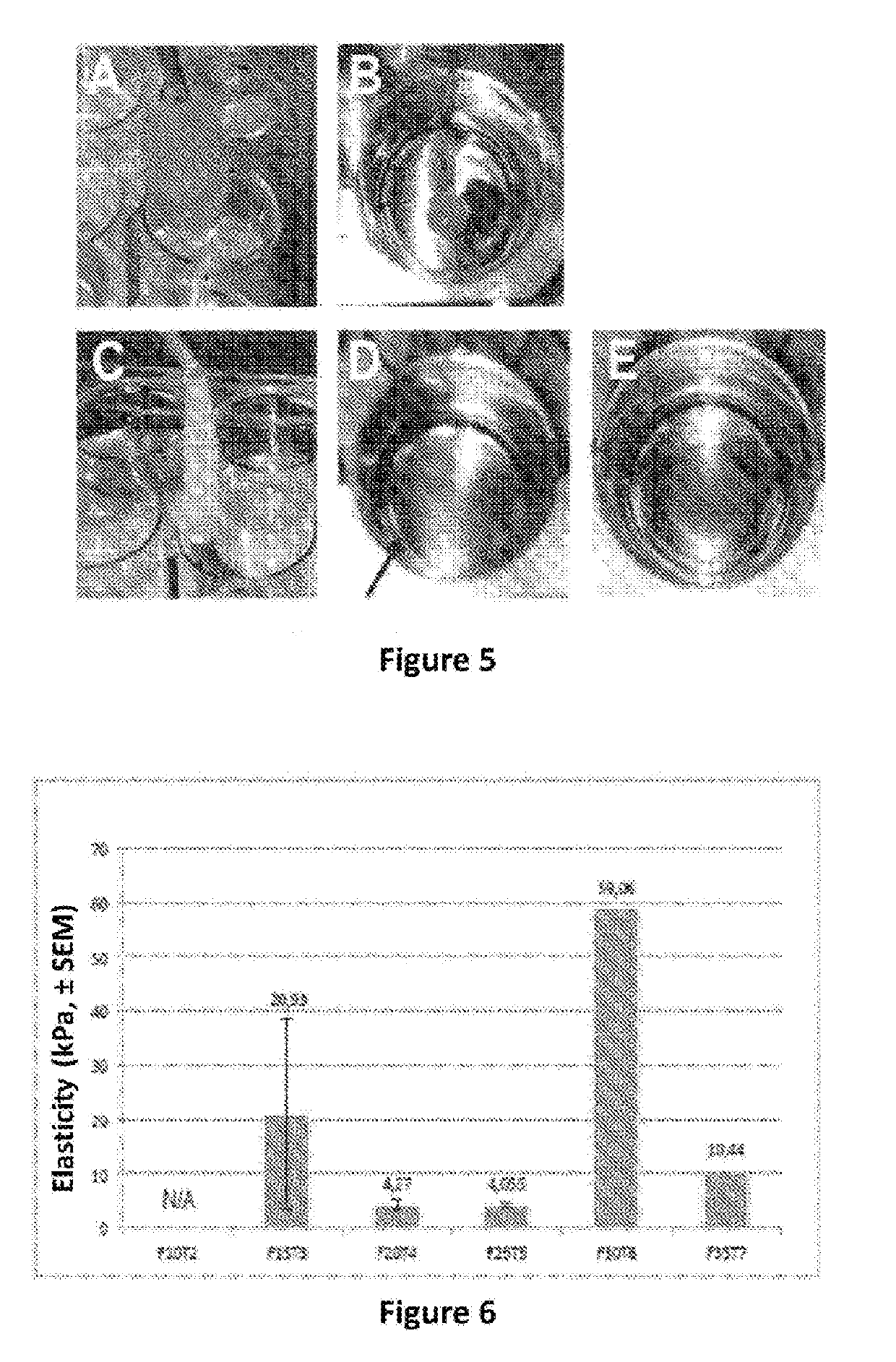 Biomaterial for therapeutic use