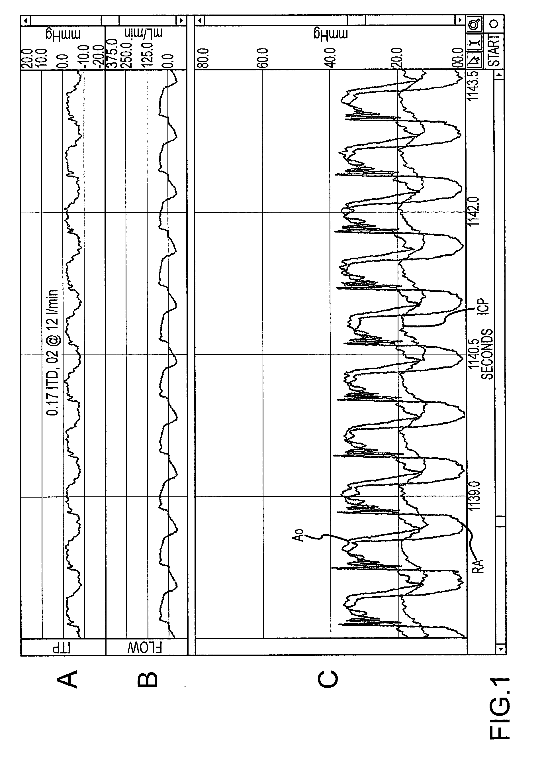 System, method, and device to increase circulation during cpr without requiring positive pressure ventilation