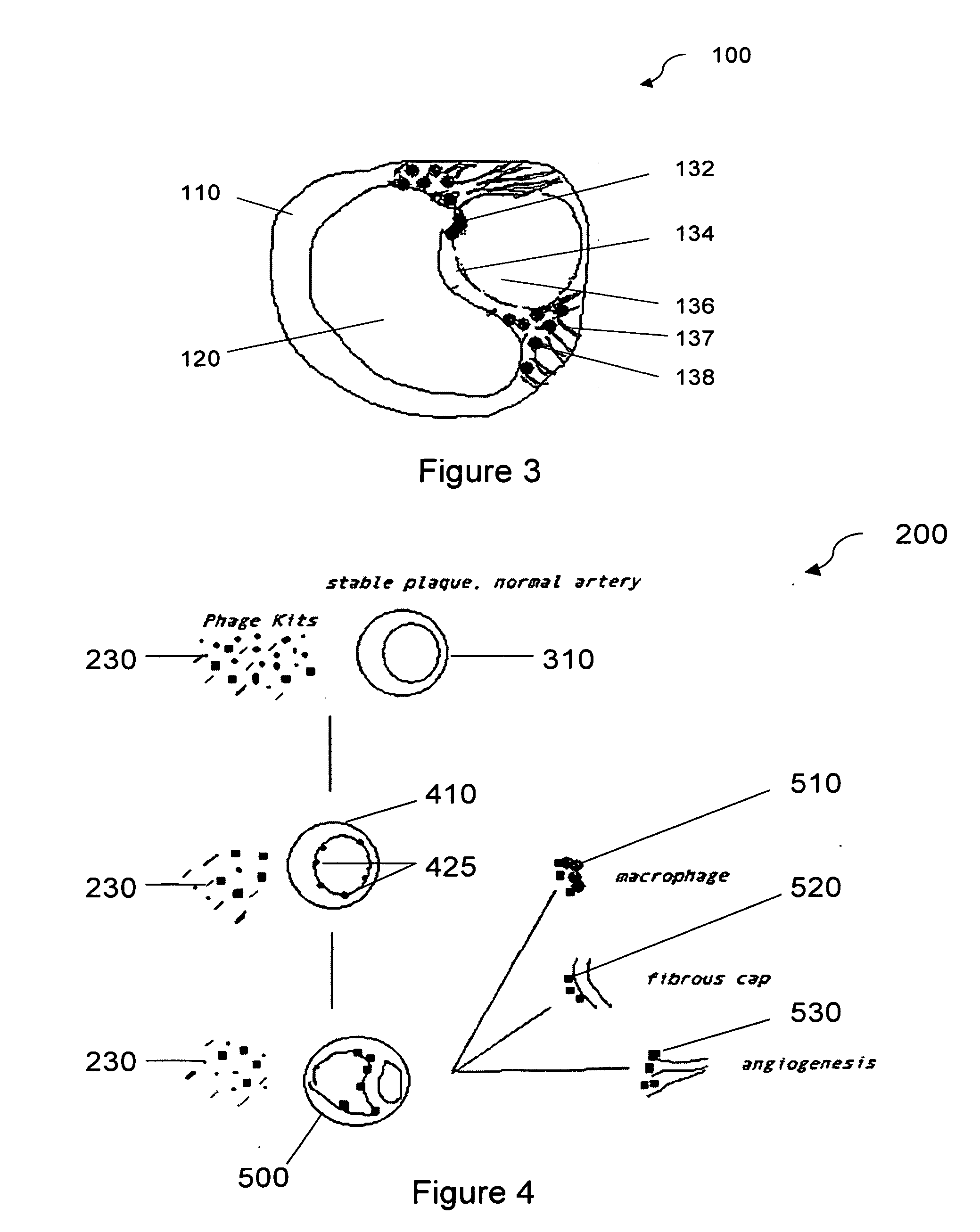 Biomarkers of vulnerable atherosclerotic plaques and methods of use