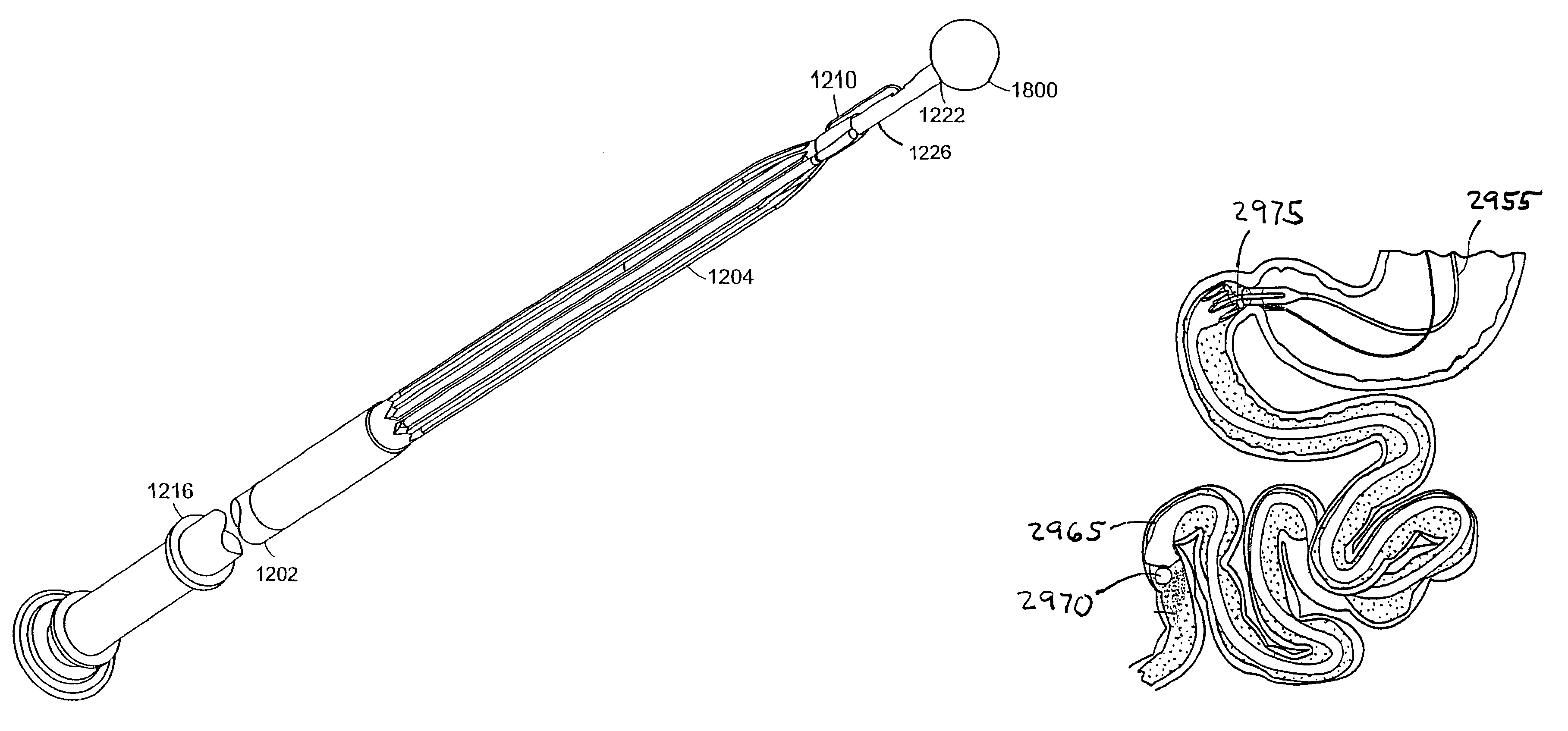 Atraumatic delivery devices